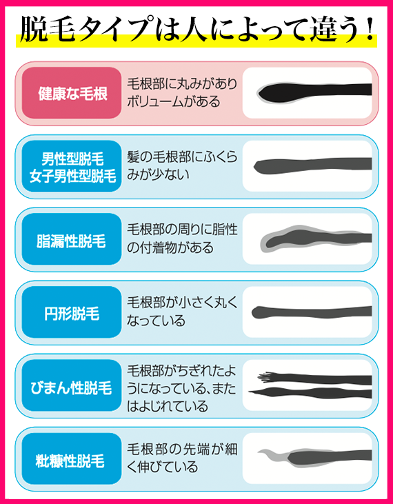 髪の毛のプロが、あなたの未来をサポート